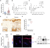 Image for Targeting Aquaporin-3 Attenuates Skin Inflammation in Rosacea