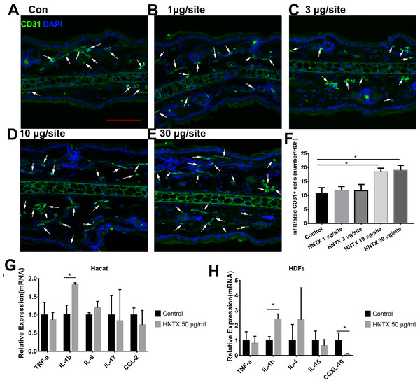 Image for Haplopelma hainanum venom induces inflammatory skin lesions
