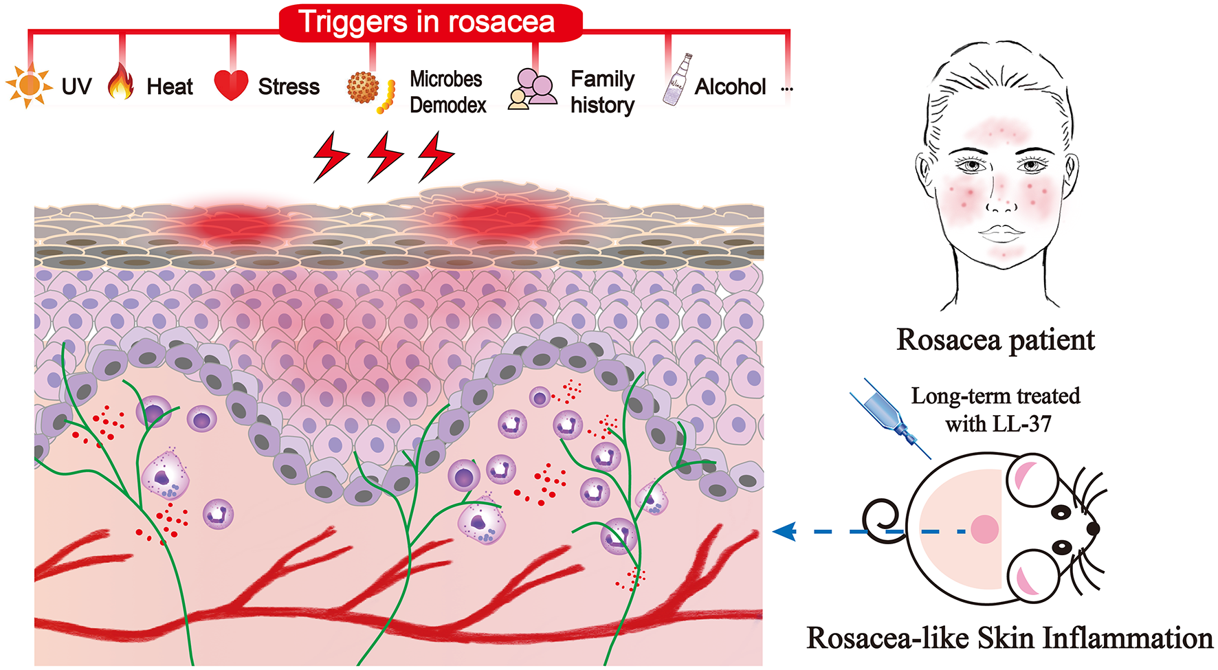 Image for Mouse model of a long-term rosacea-like skin inflammation