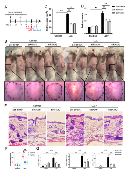 Image for TLR7 promotes skin inflammation via activating NFκB-mTORC1 axis in rosacea