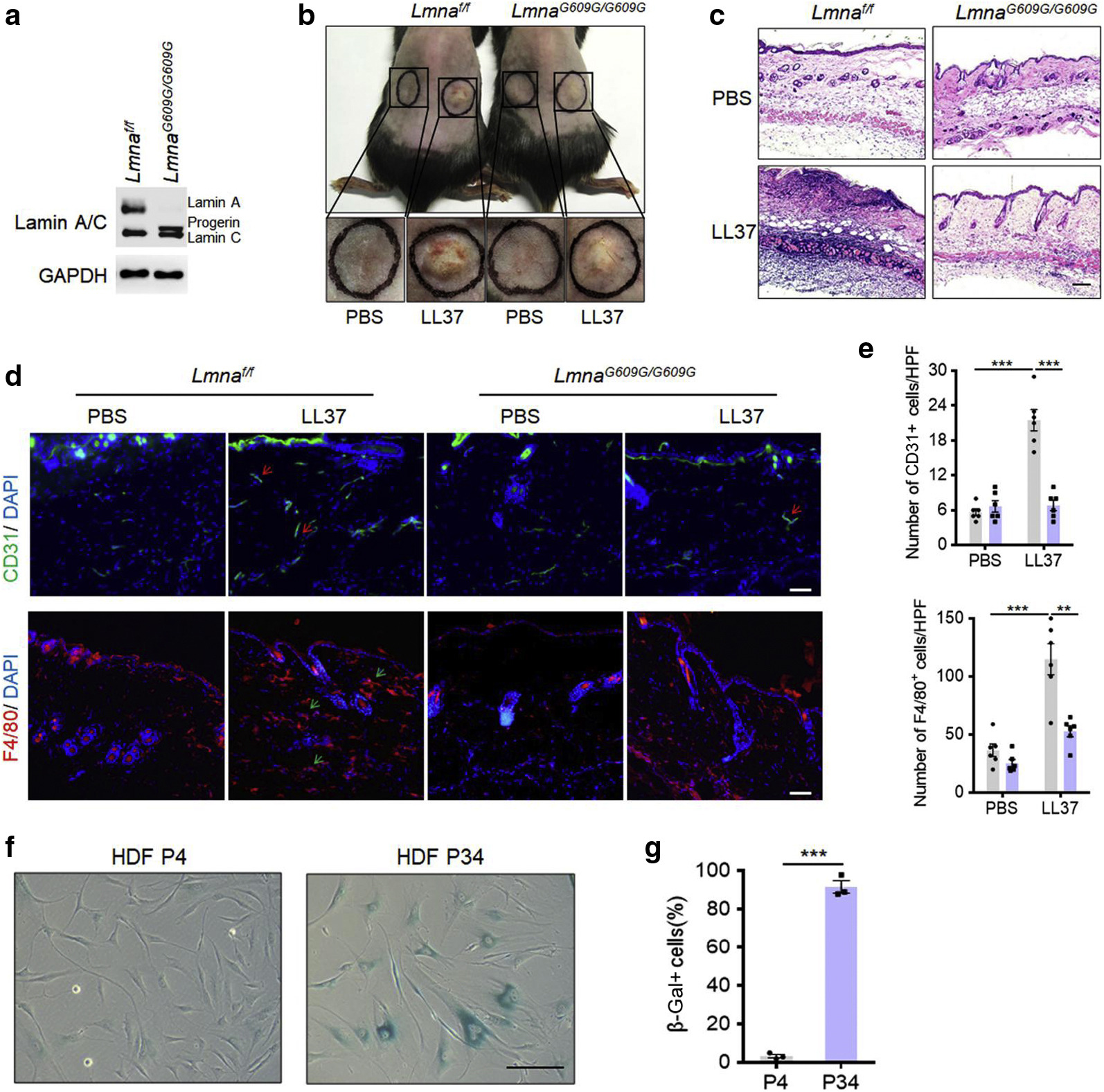 Image for Aging-Conferred SIRT7 Decline Inhibits Rosacea-Like Skin Inflammation by Modulating Toll-Like Receptor 2‒NF-κB Signaling