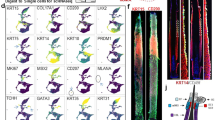 Image for Single-cell transcriptomics reveals hair growth retardation mediated by aberrant connective tissue sheath contraction in male androgenetic alopecia