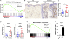 Image for mTORC1-Mediated Angiogenesis is Required for the Development of Rosacea