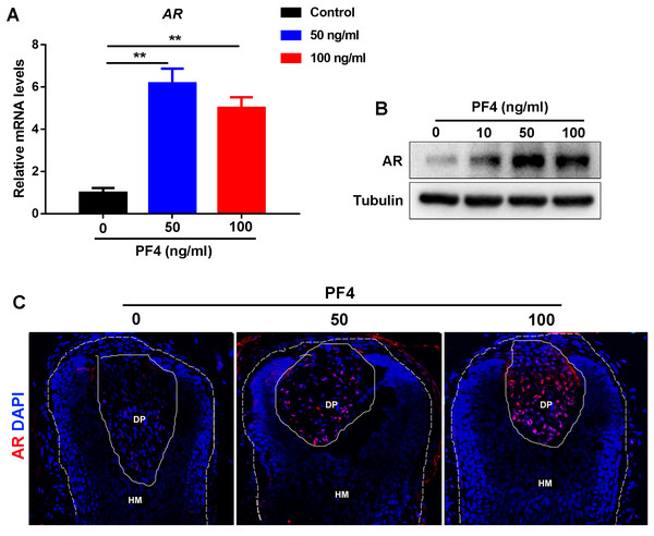 Image for Platelet factor 4 inhibits human hair follicle growth and promotes androgen receptor expression in human dermal papilla cells