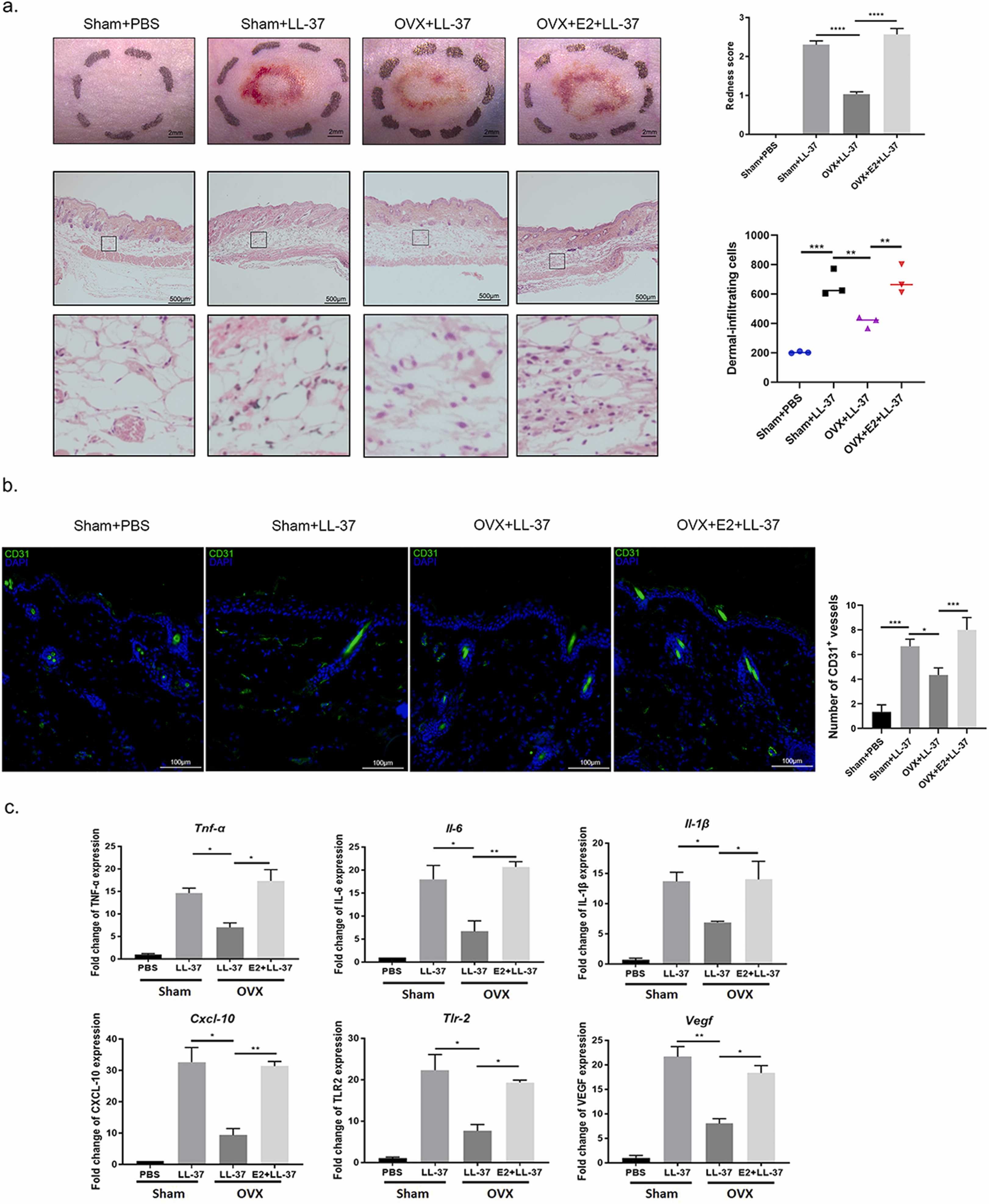 Image for 17β-Estradiol promotes LL37-induced rosacea-like skin inflammation via G protein-coupled estrogen receptor 30