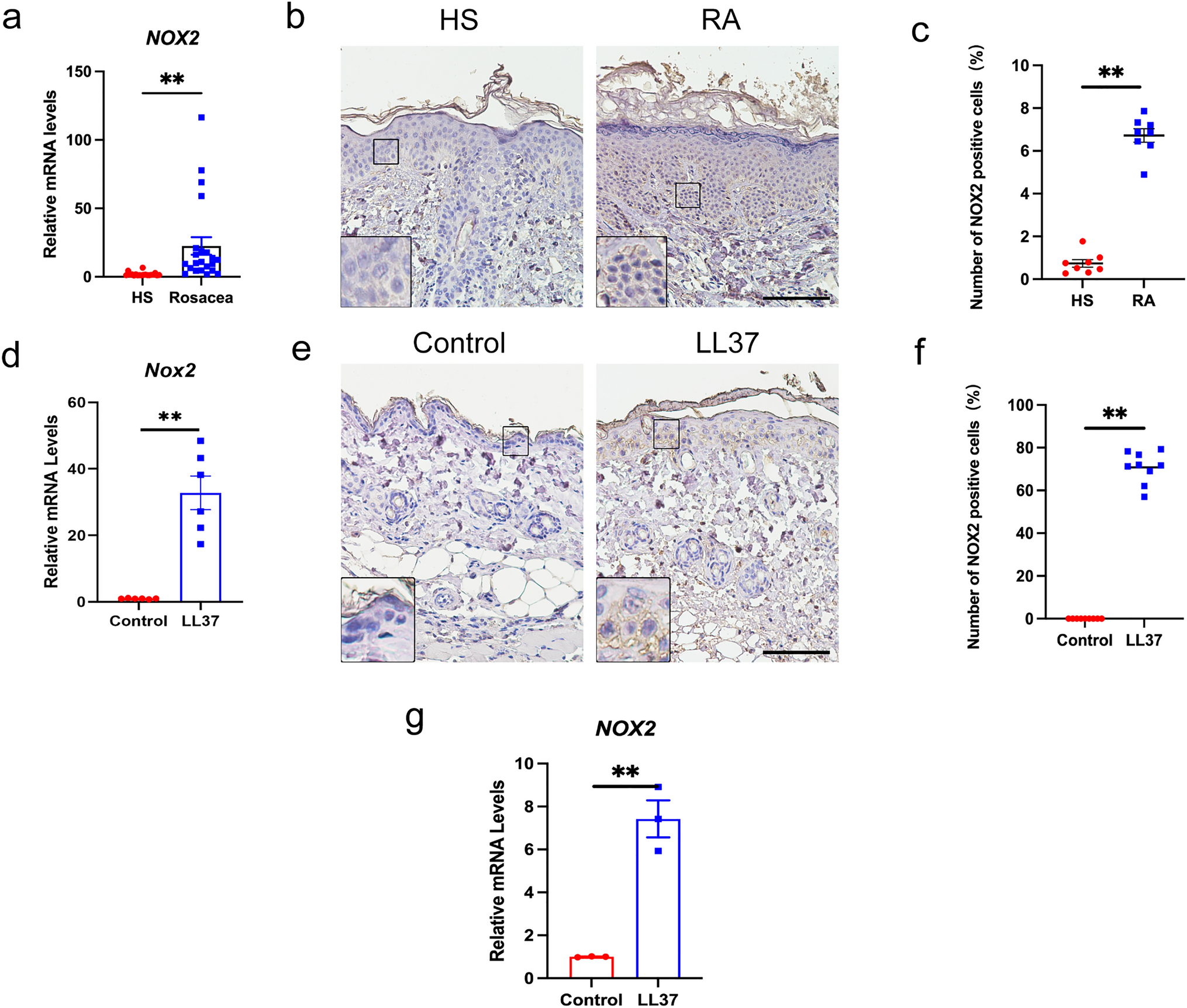 Image for Oxidative stress mediated by the NOX2/ROS/NF-κB signaling axis is involved in rosacea