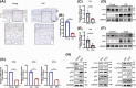 Image for Depletion of Fat Mass and Obesity-Associated Protein (FTO) Drives Heterochromatin Loss via Lysine Acetyltransferase 8 (KAT8)-Mediated Remodeling and Spacing Factor 1 (RSF1) Acetylation in Skin Aging