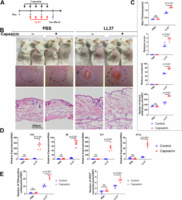 Image for High-sensitive sensory neurons exacerbate rosacea-like dermatitis in mice by activating γδ T cells directly
