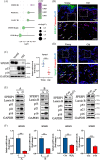Image for Downregulated SPESP1-driven fibroblast senescence decreases wound healing in aged mice