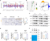 Image for WTAP Mediated N6-methyladenosine RNA Modification of ELF3 Drives Cellular Senescence by Upregulating IRF8
